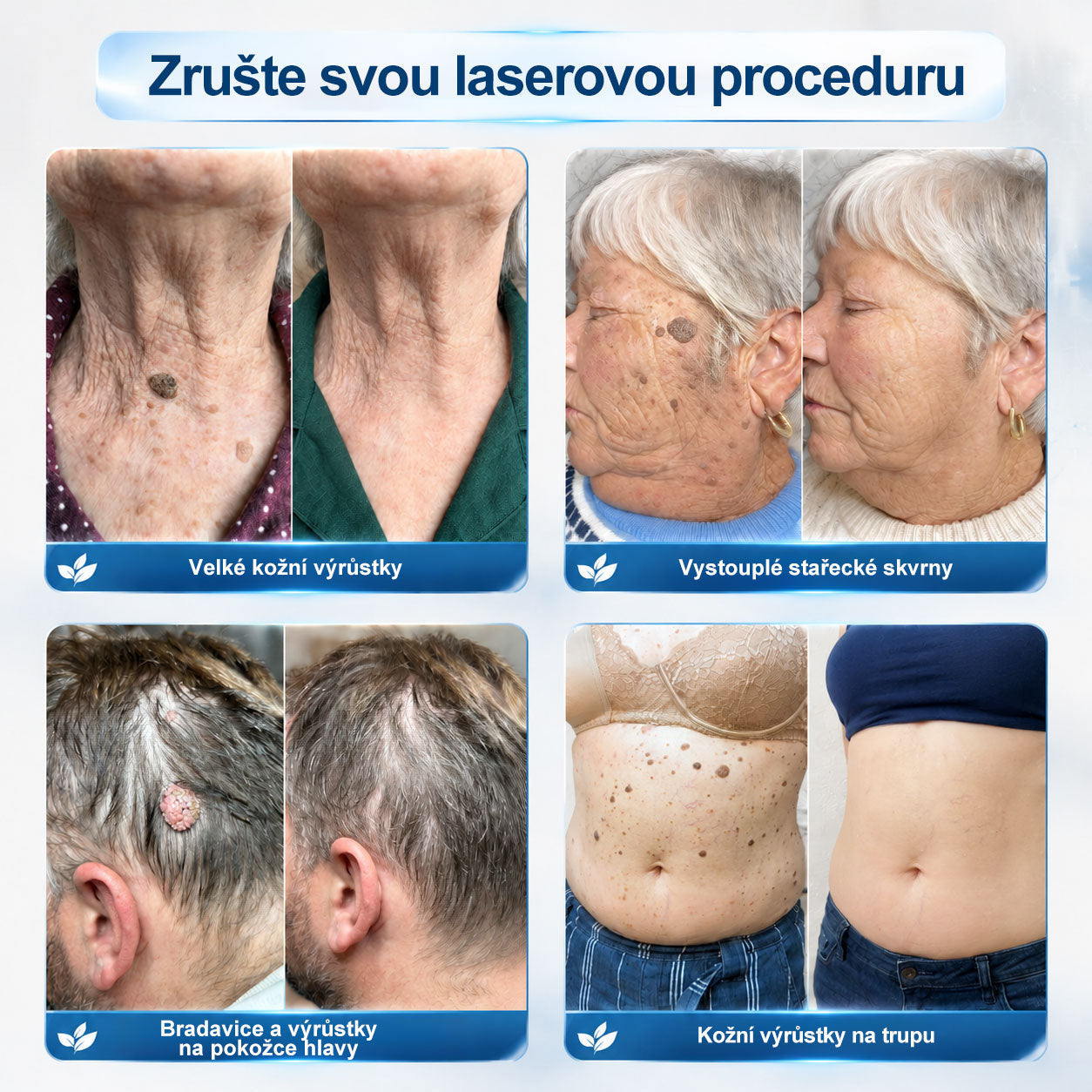 🔥 Odemčete si 50% vylepšení! Než se vrátíte do objednávky, přidejte si položku z 𝐇𝐢𝐬𝐤𝐢𝐧® a co nejdříve posuňte svou rutinu na další úroveň. ⏳ Tato překvapivá nabídka zmizí v okamžiku, kdy opustíte tuto stránku.