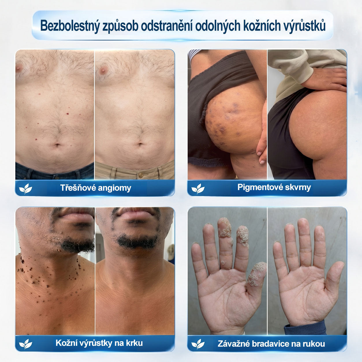 🔥 Odemčete si 50% vylepšení! Než se vrátíte do objednávky, přidejte si položku z 𝐇𝐢𝐬𝐤𝐢𝐧® a co nejdříve posuňte svou rutinu na další úroveň. ⏳ Tato překvapivá nabídka zmizí v okamžiku, kdy opustíte tuto stránku.