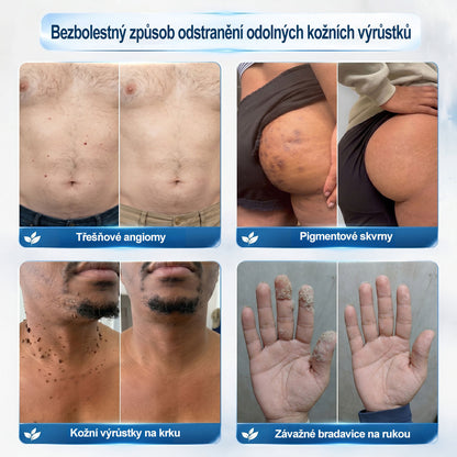 🔥 Odemčete si 50% vylepšení! Než se vrátíte do objednávky, přidejte si položku z 𝐇𝐢𝐬𝐤𝐢𝐧® a co nejdříve posuňte svou rutinu na další úroveň. ⏳ Tato překvapivá nabídka zmizí v okamžiku, kdy opustíte tuto stránku.