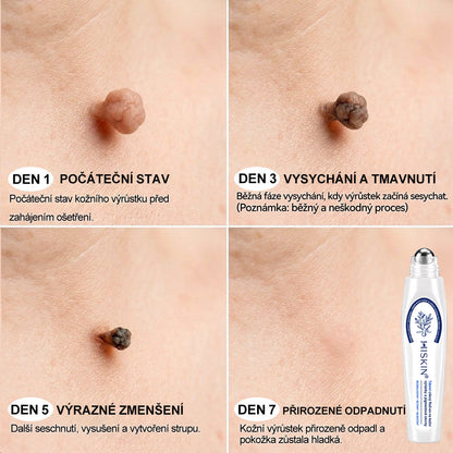 🔥 Odemčete si 50% vylepšení! Než se vrátíte do objednávky, přidejte si položku z 𝐇𝐢𝐬𝐤𝐢𝐧® a co nejdříve posuňte svou rutinu na další úroveň. ⏳ Tato překvapivá nabídka zmizí v okamžiku, kdy opustíte tuto stránku.